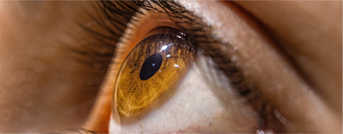 Causas da cegueira: doenças que provocam perda de visão - Clínica Tibiriça