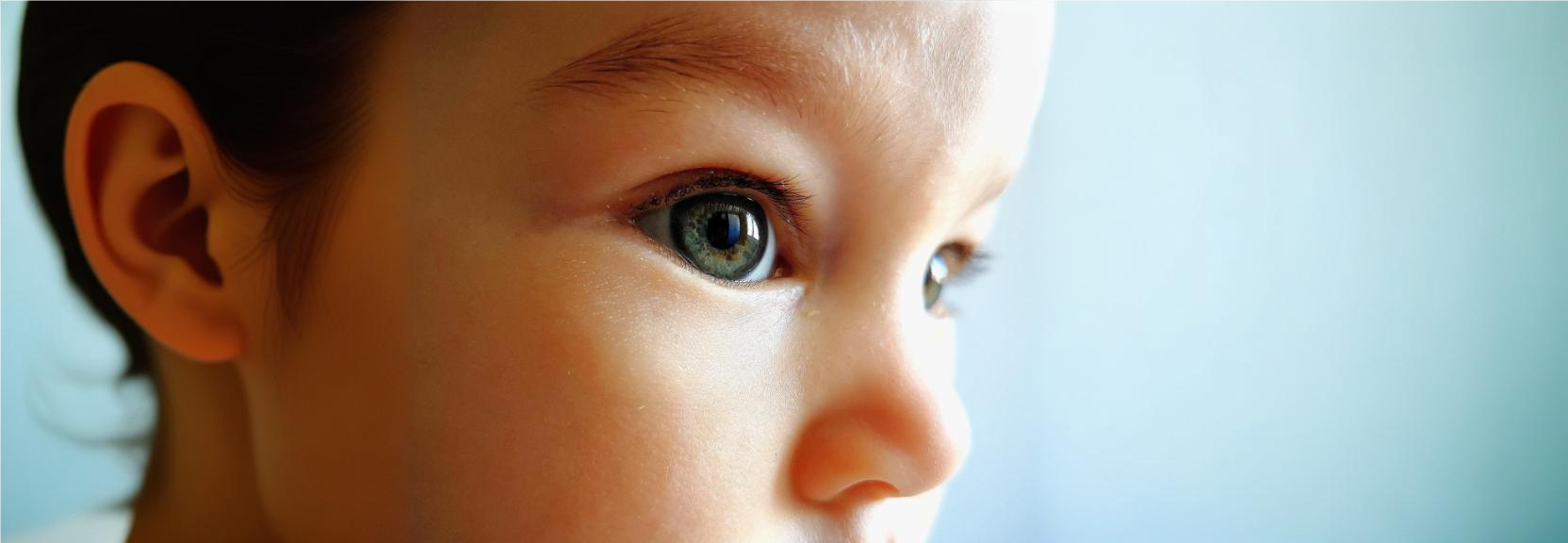 retinoblastoma